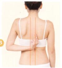 强直性脊柱炎拔罐