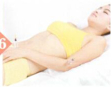 急性扁桃体炎拔罐