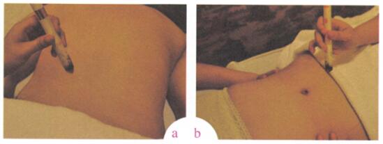 抗衰老艾灸哪个部位图解