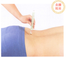 腰间盘突出症艾灸