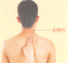 类风湿性关节炎艾灸