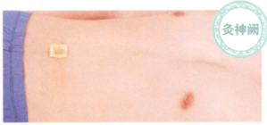 延年益寿艾灸调理方艾灸